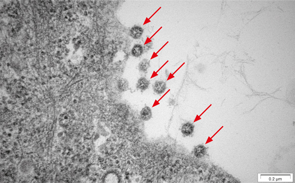Figure 1: Electron microscope image of the SARS-CoV-2 B.1 wild type. Kindly provided by Dr. Philipp Ostermann, Institute for Virology, Heinrich-Heine University of Duesseldorf. Scale bar = 200 nm.